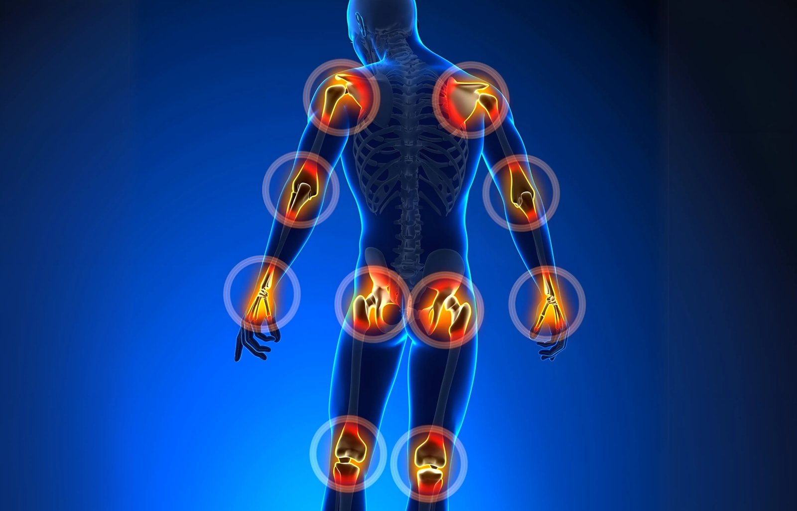 Joints pain